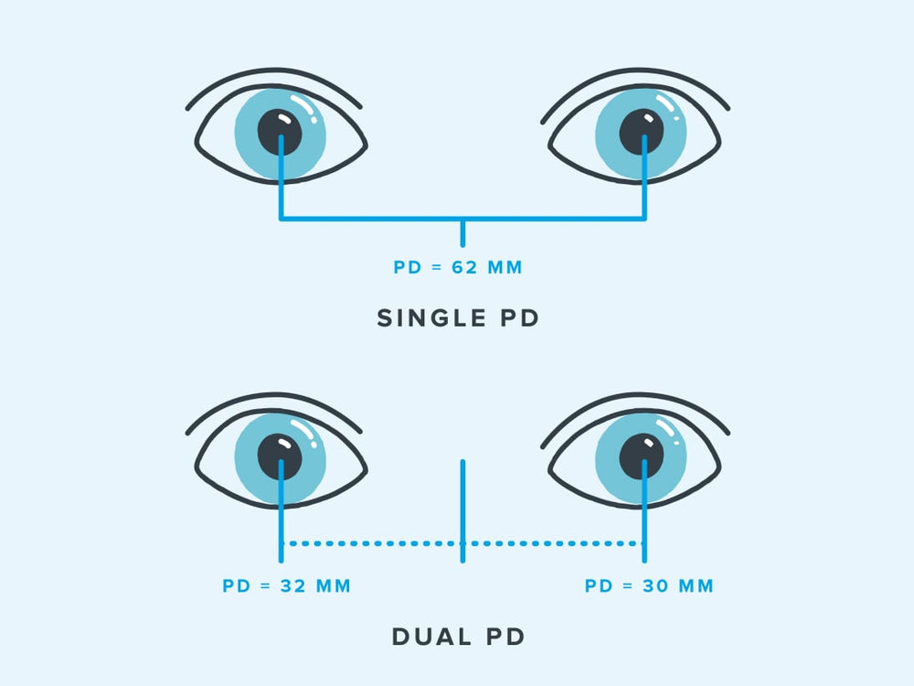 Why it matters